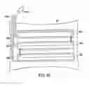 Fig. 49 - Gastric restriction devices for treating obesity
