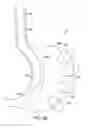 Fig. 52 - Gastric restriction devices for treating obesity