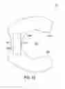 Fig. 53 - Gastric restriction devices for treating obesity