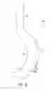 Fig. 54 - Gastric restriction devices for treating obesity