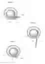 Fig. 10 - Device for treating obesity