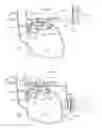 Fig. 14 - Device for treating obesity