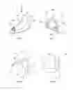 Fig. 02 - Devices and methods for nasal splinting