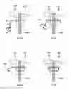 Fig. 07 - Devices and methods for nasal splinting
