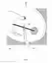 Fig. 09 - Devices and methods for nasal splinting