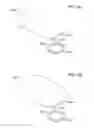 Fig. 15 - Gas filter and release for ostomy appliance