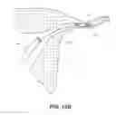 Fig. 23 - OCCLUSION DEVICE WITH OPENABLE CHANNEL