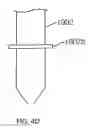 Fig. 12 - Methods and devices for pain management