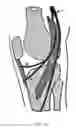 Fig. 19 - Methods and devices for pain management