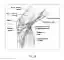 Fig. 20 - Methods and devices for pain management