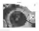 Fig. 09 - Devices and methods for creating a predictable capsulorhexis of specific diameter