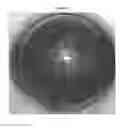 Fig. 15 - Devices and methods for creating a predictable capsulorhexis of specific diameter