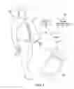 Fig. 02 - Wearable active-compression therapy and treatment system