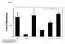 Fig. 06 - Amorphous and a crystalline form of genz 112638 hemitartrate as inhibitor of glucosylceramide synthase