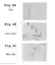 Fig. 04 - Method for treating a degenerative disease of the nervous system using 3-methoxy-pregnenolone or derivatives thereof