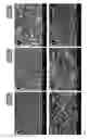 Fig. 02 - Method for producing an osteoinductive calcium phosphate and products thus obtained