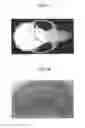 Fig. 02 - Material for Treatment of Cerebral Infarction