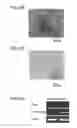 Fig. 12 - Material for Treatment of Cerebral Infarction