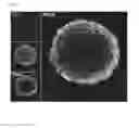 Fig. 05 - MACROMOLECULAR CLUSTERS OF CARDIAC STEM CELLS AND METHODS FOR MAKING AND USING THEM
