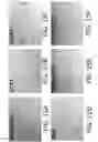 Fig. 16 - METHODS OF TREATING A CANCER THROUGH TARGETED DISRUPTION OF ALPHA CONNEXIN 43-ZONULA OCCLUDENS-1 (ZO-1) INTERACTION