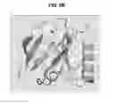 Fig. 10 - METHOD OF TREATING MYASTHENIA GRAVIS