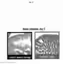 Fig. 16 - Protection against apoptosis from ionizing radiation