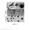 Fig. 06 - COLLAGEN-TARGETED NANOPARTICLES
