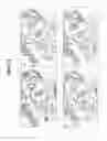 Fig. 03 - Compositions and methods for treating celiac sprue disease
