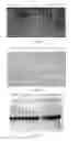 Fig. 04 - EV71 virus-like particles and preparation method and application thereof