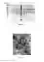 Fig. 05 - EV71 virus-like particles and preparation method and application thereof