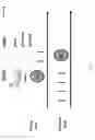 Fig. 10 - Mini-intronic plasmid DNA vaccines in combination with LAG3 blockade