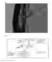 Fig. 05 - DELIVERY COMPOSITION FOR TOPICAL APPLICATIONS AND INJECTIONS AND OPHTHALMIC FORMULATIONS, METHODS FOR MANUFACTURING THEREOF, AND METHODS FOR DELIVERY OF A DRUG-DELIVERY COMPOSITION
