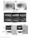 Fig. 09 - Immune-compromised zebrafish