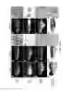 Fig. 13 - Immune-compromised zebrafish