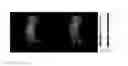 Fig. 05 - Nanoparticle Diagnostic and Methods for Treating Disease