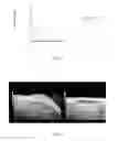 Fig. 06 - Nanobubbles