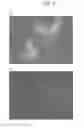 Fig. 06 - COMPOSITIONS AND METHODS FOR DETECTING OR ELIMINATING SENESCENT CELLS TO DIAGNOSE OR TREAT DISEASE