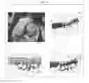 Fig. 13 - Cartilage-damage treatment agent and method for producing same