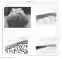 Fig. 16 - Cartilage-damage treatment agent and method for producing same
