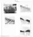Fig. 17 - Cartilage-damage treatment agent and method for producing same
