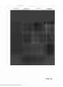 Fig. 20 - OSTEOINDUCTIVE MATERIALS