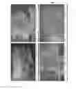 Fig. 22 - OSTEOINDUCTIVE MATERIALS