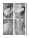 Fig. 23 - OSTEOINDUCTIVE MATERIALS