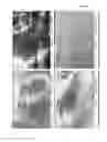 Fig. 24 - OSTEOINDUCTIVE MATERIALS