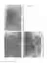 Fig. 26 - OSTEOINDUCTIVE MATERIALS