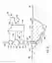 Fig. 09 - Apparatus and method for wound volume measurement