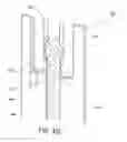 Fig. 54 - Apparatuses and methods for wound therapy