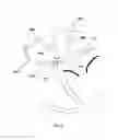 Fig. 03 - INTRAATRIAL VENTRICULAR ASSIST DEVICE