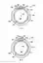 Fig. 08 - INTRAATRIAL VENTRICULAR ASSIST DEVICE