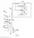 Fig. 11 - INTRAATRIAL VENTRICULAR ASSIST DEVICE